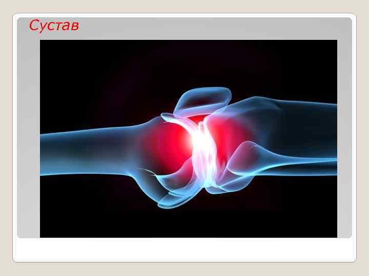 Сустав 