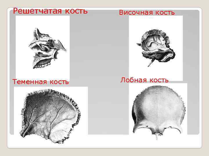 Решетчатая кость Височная кость Теменная кость Лобная кость 