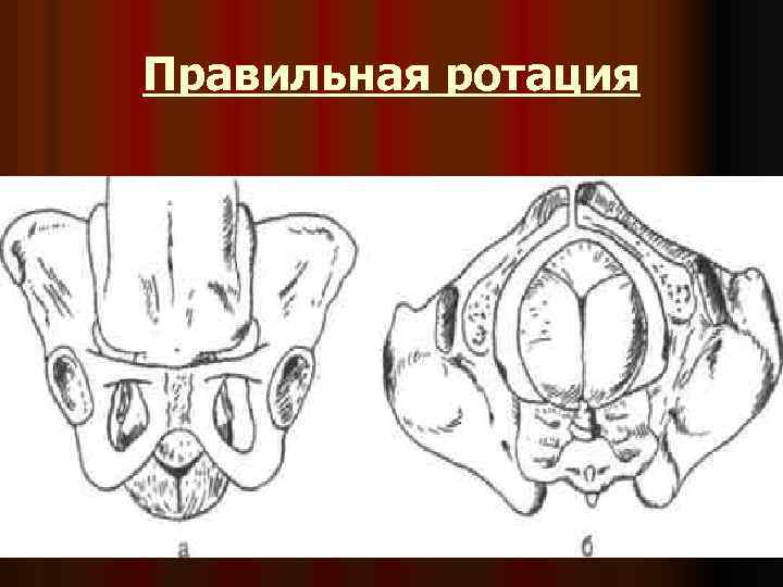 Правильная ротация 