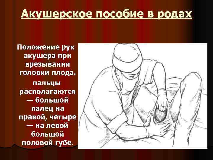 Роды пособие. Акушерское пособие при родах. Оказание акушерского пособия в родах. Ручное акушерское пособие при головном предлежании.