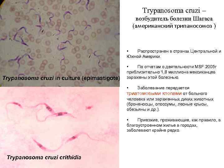 Trypanosoma cruzi – возбудитель болезни Шагаса (американский трипаносомоз ) • Распространен в странах Центральной