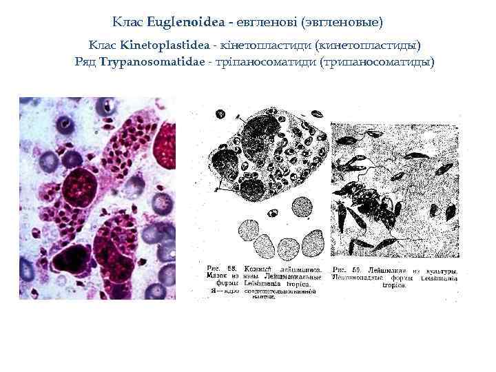 Клас Euglenoidea - евгленові (эвгленовые) Клас Kinetoplastidea - кінетопластиди (кинетопластиды) Ряд Trypanosomatidae - тріпаносоматиди