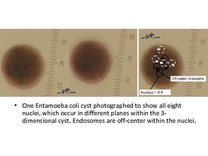  • One Entamoeba coli cyst photographed to show all eight nuclei, which occur