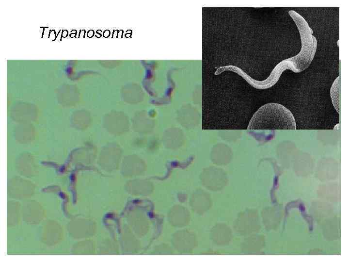 Trypanosoma 