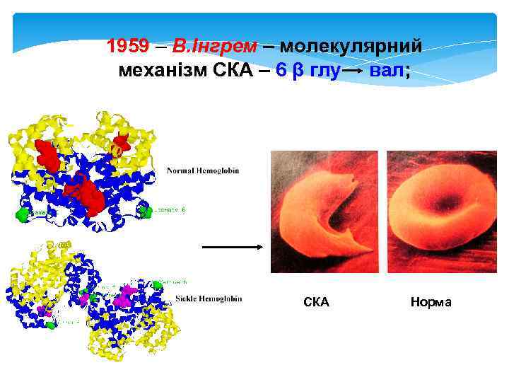 1959 – В. Інгрем – молекулярний механізм СКА – 6 β глу вал; СКА