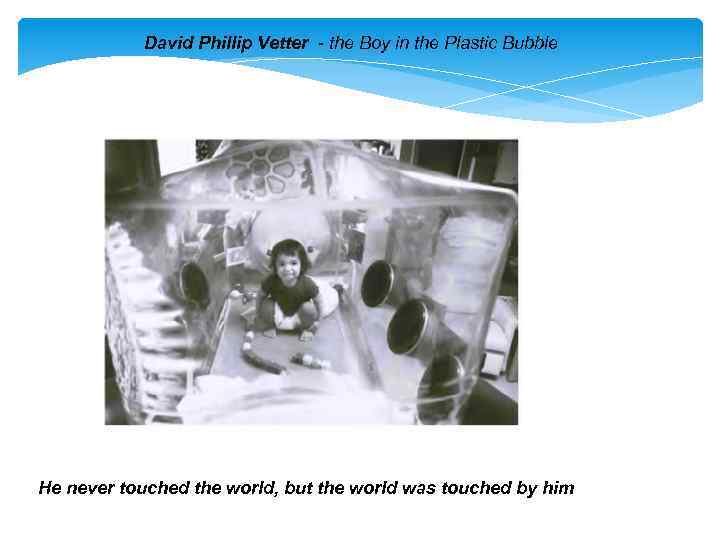 David Phillip Vetter - the Boy in the Plastic Bubble He never touched the