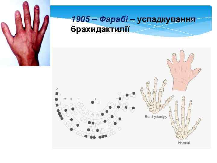 1905 – Фарабі – успадкування брахидактилії 