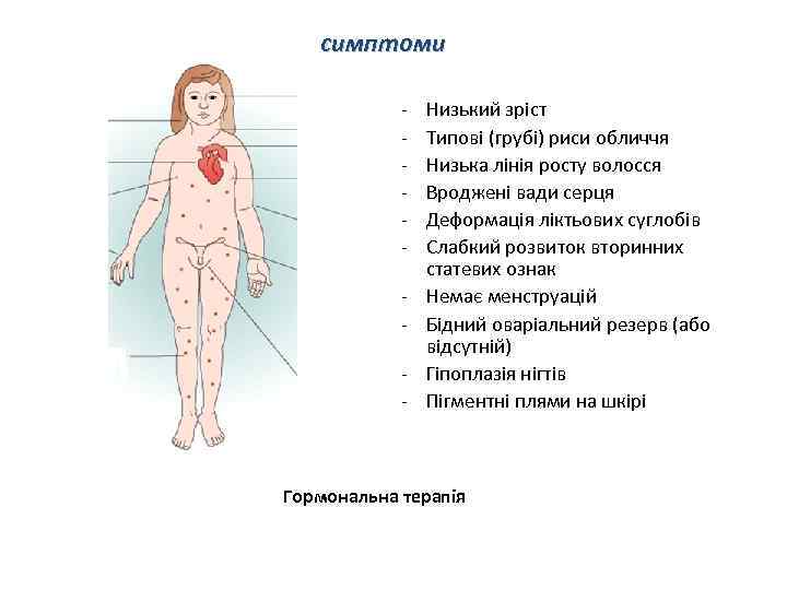 симптоми - Низький зріст Типові (грубі) риси обличчя Низька лінія росту волосся Вроджені вади