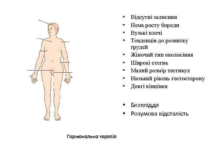  • • • Відсутні залисини Нема росту бороди Вузькі плечі Тенденція до розвитку