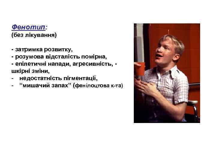 Фенотип: (без лікування) - затримка розвитку, - розумова відсталість помірна, - епілетичні напади, агресивність,
