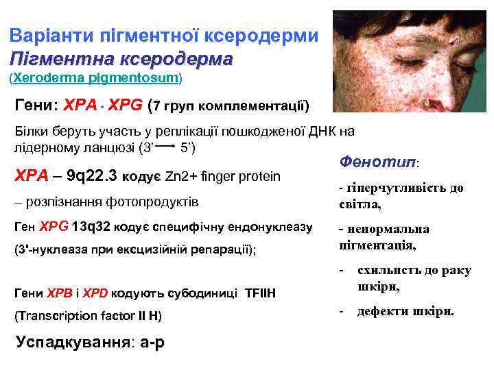 Варіанти пігментної ксеродерми Пігментна ксеродерма (Xeroderma pigmentosum) Гени: XPA - XPG (7 груп комплементації)
