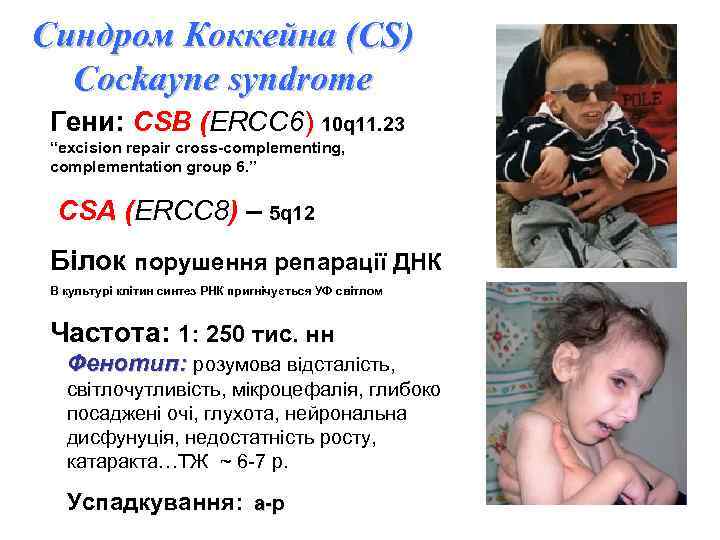 Синдром Коккейна (CS) Сockayne syndrome Гени: CSB (ERCC 6) 10 q 11. 23 “excision