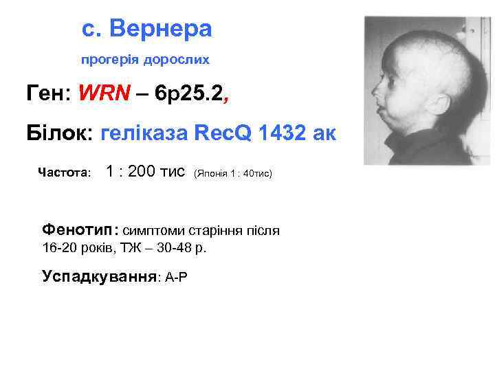 с. Вернера прогерія дорослих Ген: WRN – 6 p 25. 2, Білок: геліказа Rec.