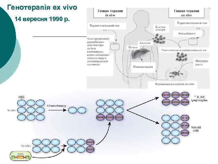 Генотерапія ex vivo 14 вересня 1990 р. 