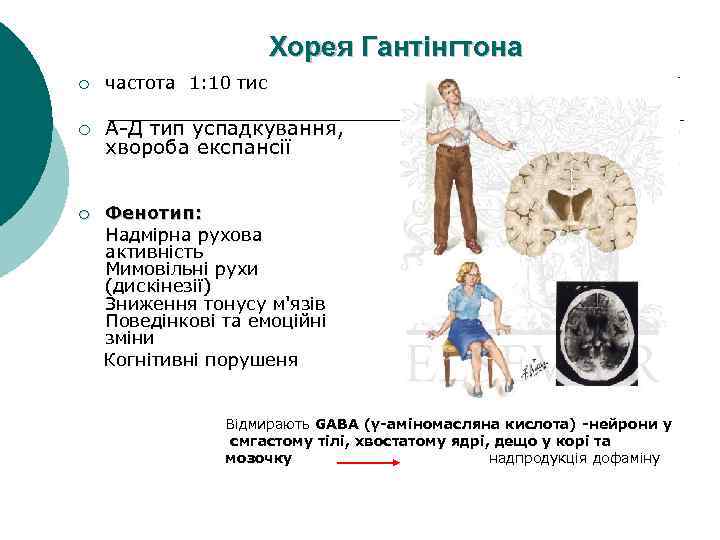 Хорея Гантінгтона ¡ ¡ частота 1: 10 тис А-Д тип успадкування, хвороба експансії Фенотип: