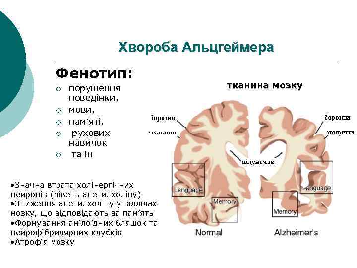 Хвороба Альцгеймера Фенотип: ¡ ¡ ¡ порушення поведінки, мови, пам’яті, рухових навичок та ін