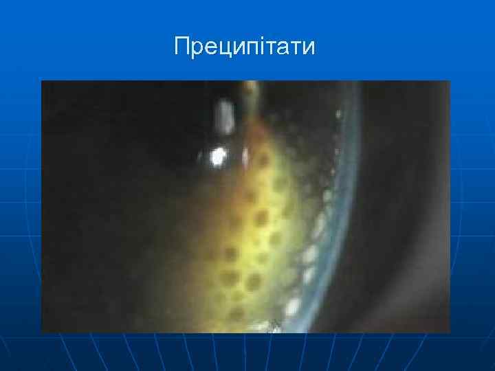 Преципітати 