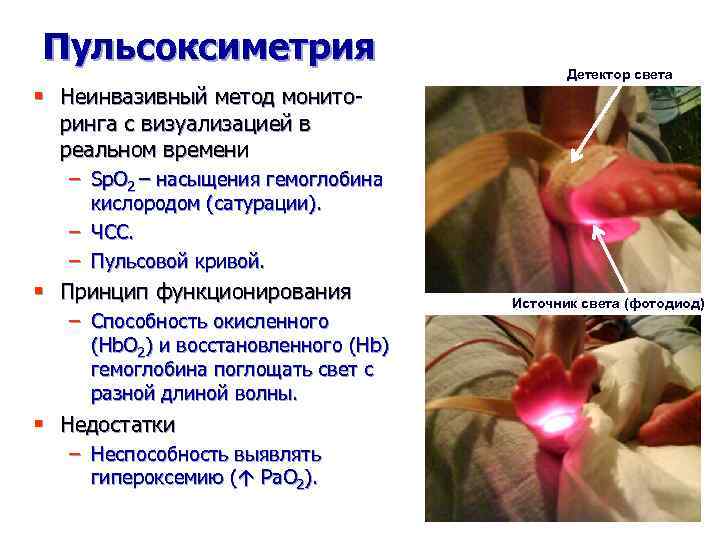 Пульсоксиметрия Детектор света § Неинвазивный метод мониторинга с визуализацией в реальном времени – Sp.