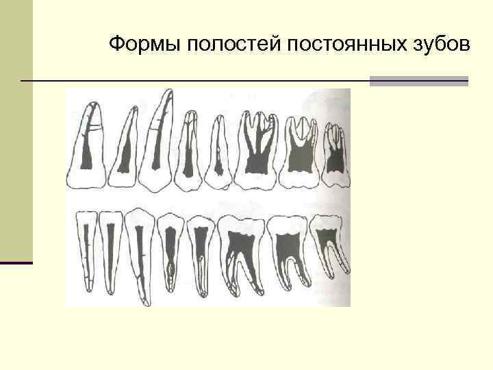 Формы полостей постоянных зубов 