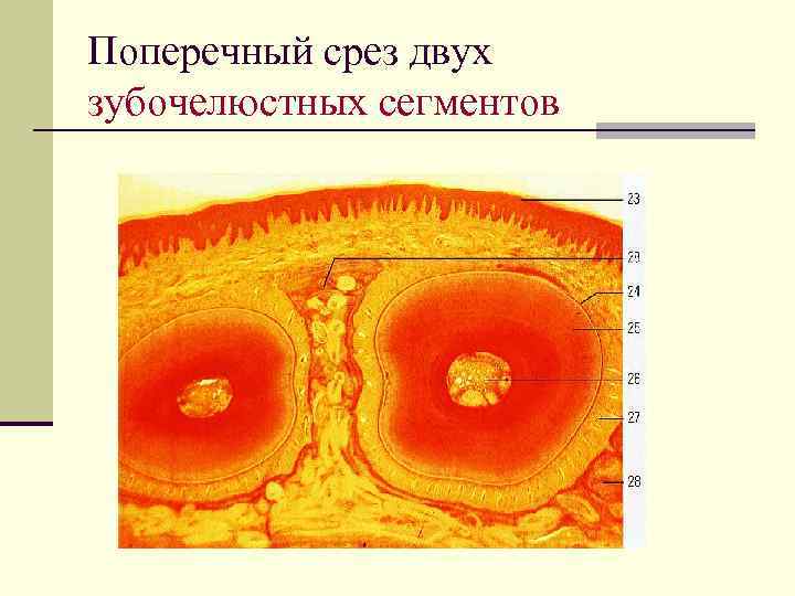 Поперечный срез двух зубочелюстных сегментов 