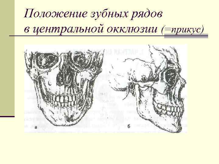 Положение зубных рядов в центральной окклюзии (=прикус) 