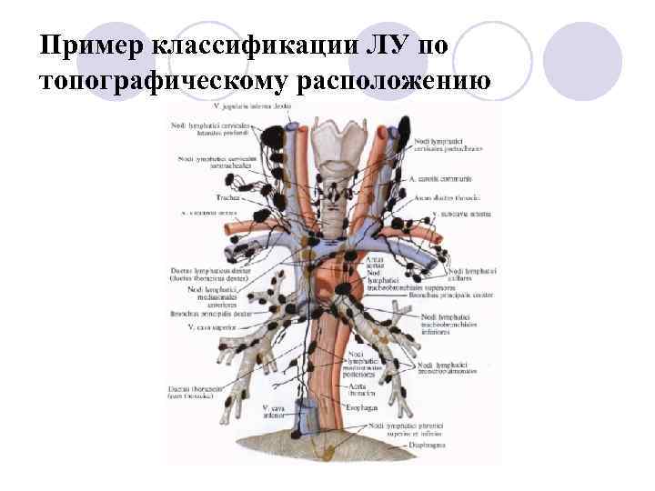 Пример классификации ЛУ по топографическому расположению 