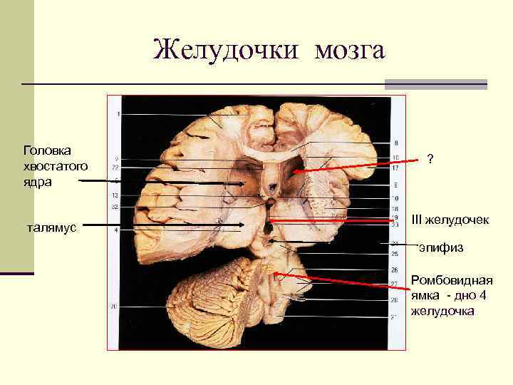 Желудочки мозга Головка хвостатого ядра талямус ? III желудочек эпифиз Ромбовидная ямка - дно