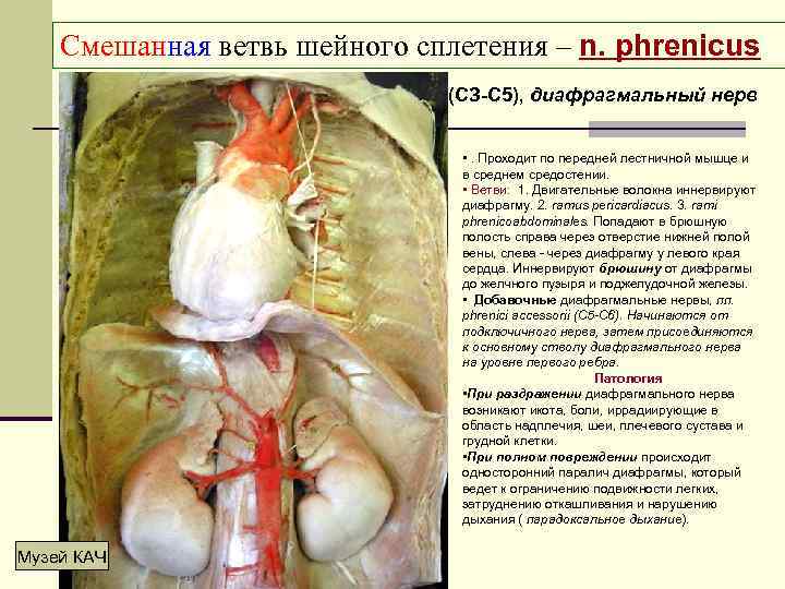 Смешанная ветвь шейного сплетения – n. phrenicus (СЗ-С 5), диафрагмальный нерв • . Проходит