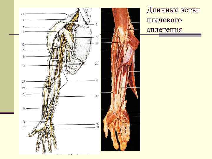 Длинные ветви плечевого сплетения