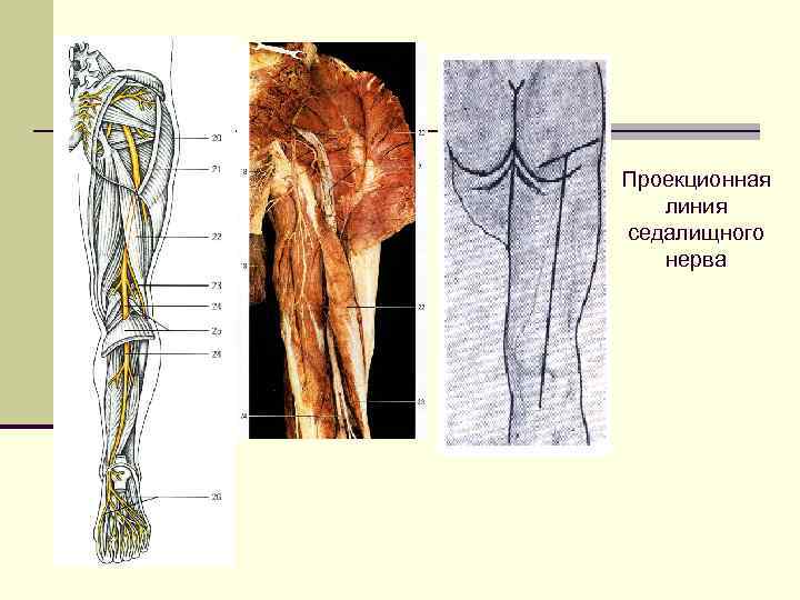 Ветви седалищного нерва схема