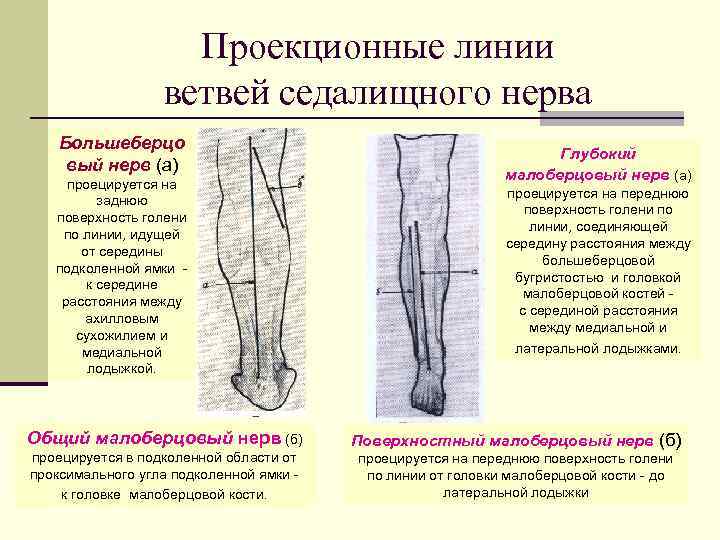 Проекционные линии ветвей седалищного нерва Большеберцо вый нерв (а) проецируется на заднюю поверхность голени