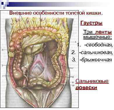 Внешние особенности толстой кишки. Гаустры Три ленты мышечные: 1. -свободная, 2. -сальниковая, 3. -брыжеечная