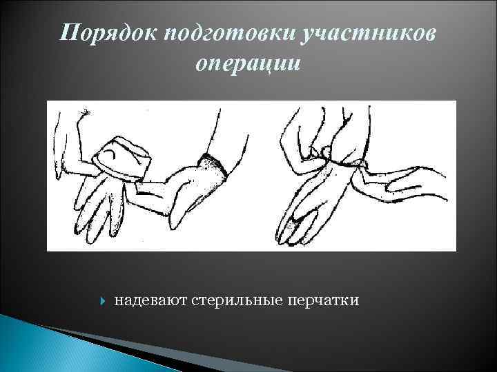 Порядок подготовки участников операции надевают стерильные перчатки 