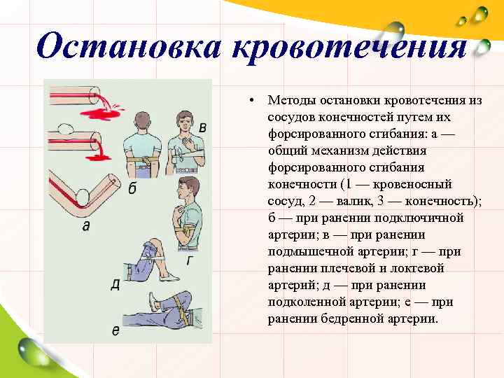 Действия при остановке наружного кровотечения. Способы остановки кровотечения. Методы остановки кровотечения из сосудов конечностей.