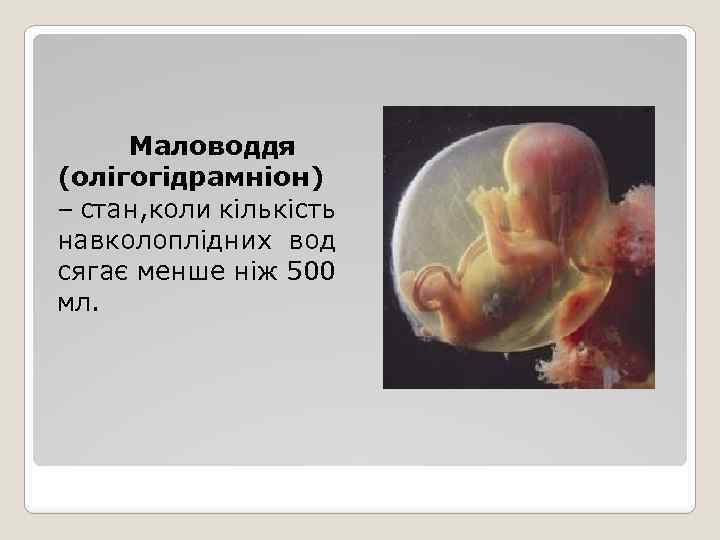  Маловоддя (олігогідрамніон) – стан, коли кількість навколоплідних вод сягає менше ніж 500 мл.