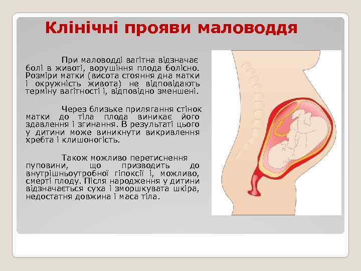 Клінічні прояви маловоддя При маловодді вагітна відзначає болі в животі, ворушіння плода болісно. Розміри