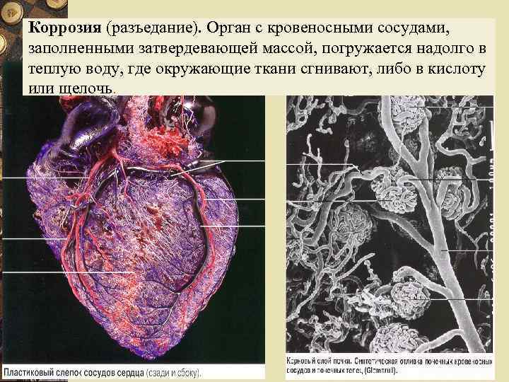 Коррозия (разъедание). Орган с кровеносными сосудами, заполненными затвердевающей массой, погружается надолго в теплую воду,