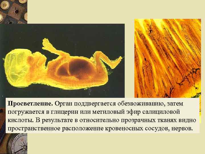 Просветление. Орган поддвергается обезвоживанию, затем Человеческий плод (конец 3 месяца). погружается в глицерин или