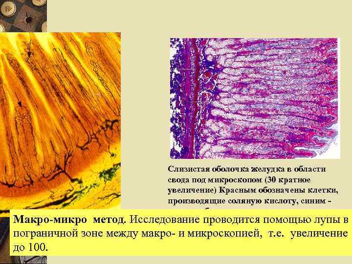 Слизистая оболочка желудка в области свода под микроскопом (30 кратное увеличение) Красным обозначены клетки,