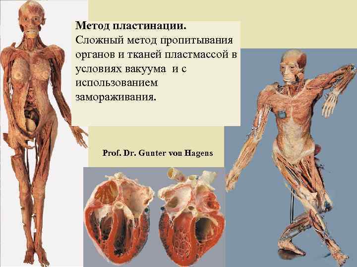 Метод пластинации. Сложный метод пропитывания органов и тканей пластмассой в условиях вакуума и с