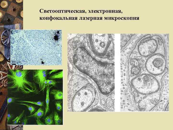 Светооптическая, электронная, конфокальная лазерная микроскопия 