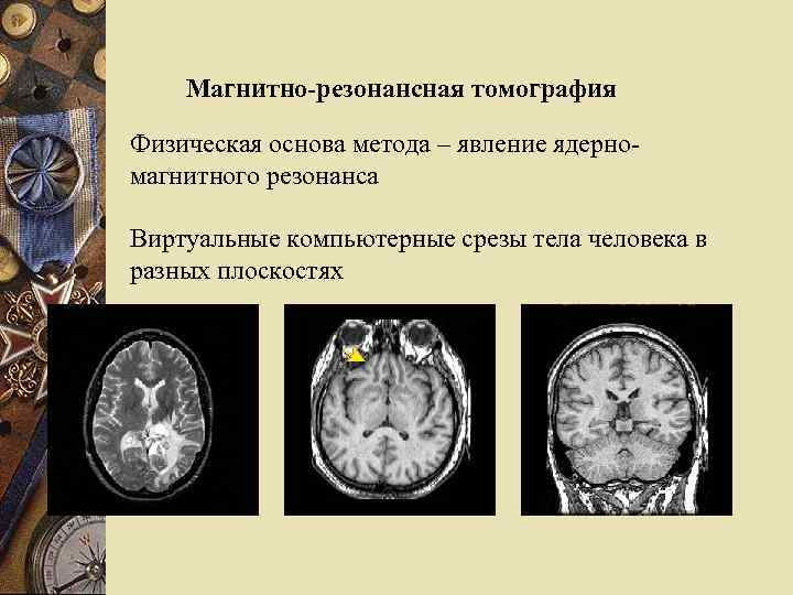 Магнитно-резонансная томография Физическая основа метода – явление ядерномагнитного резонанса Виртуальные компьютерные срезы тела человека