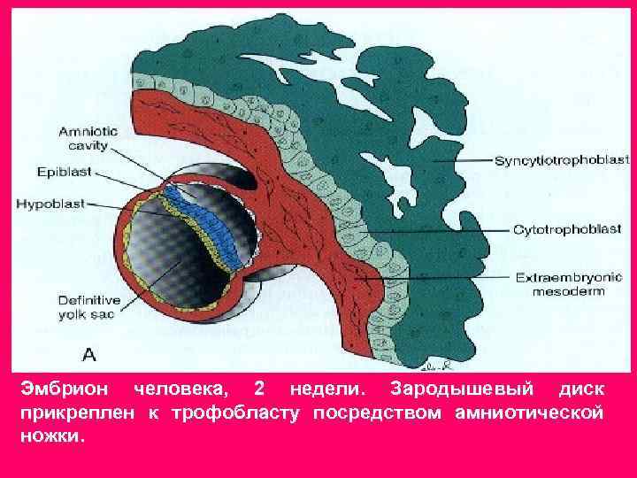 Эмбрион человека, 2 недели. Зародышевый диск прикреплен к трофобласту посредством амниотической ножки. 