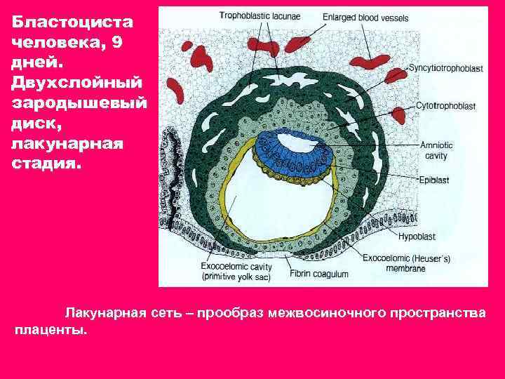 Бластоциста человека, 9 дней. Двухслойный зародышевый диск, лакунарная стадия. Лакунарная сеть – прообраз межвосиночного