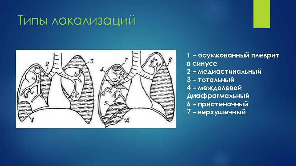 Плевра топографическая анатомия презентация