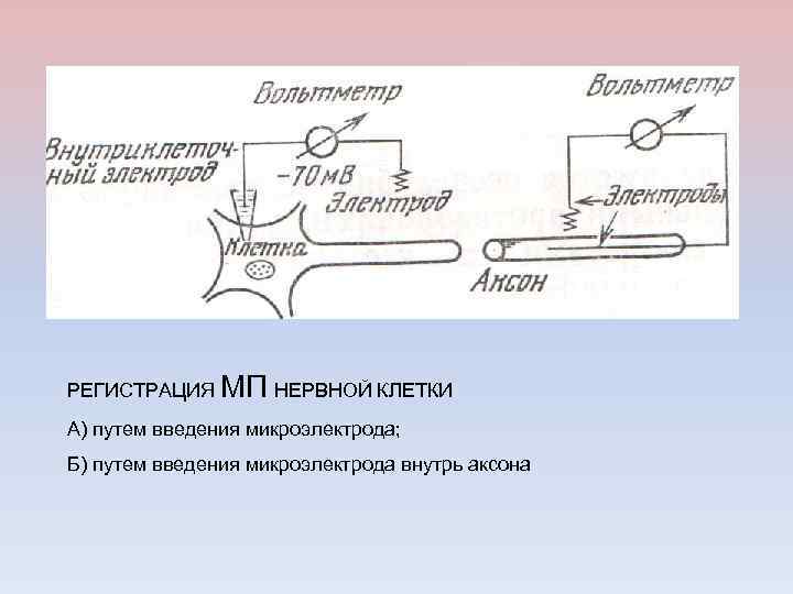 РЕГИСТРАЦИЯ МП НЕРВНОЙ КЛЕТКИ А) путем введения микроэлектрода; Б) путем введения микроэлектрода внутрь аксона