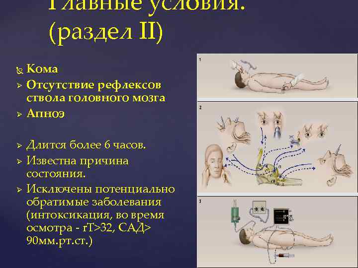 Главные условия. (раздел II) Ø Ø Ø Кома Отсутствие рефлексов ствола головного мозга Апноэ