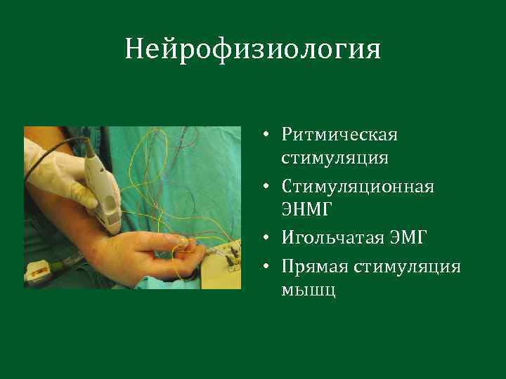 Нейрофизиология • Ритмическая стимуляция • Стимуляционная ЭНМГ • Игольчатая ЭМГ • Прямая стимуляция мышц