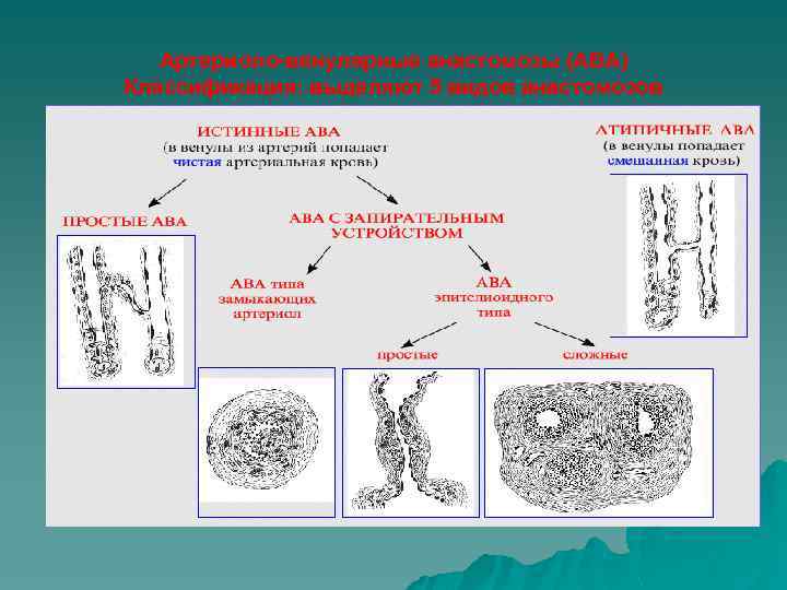 Артериоло-венулярные анастомозы (АВА) Классификация: выделяют 5 видов анастомозов 