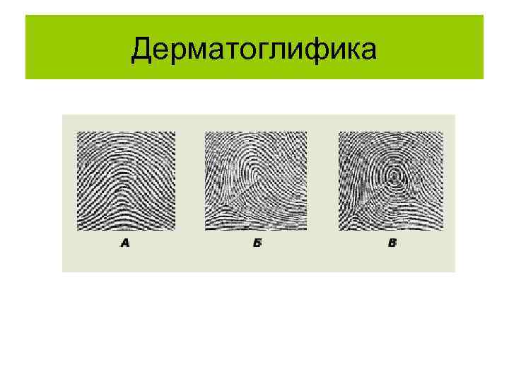 Дерматоглифика 